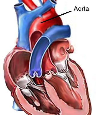 Insufficienza aortica: perché si rischia la vita
