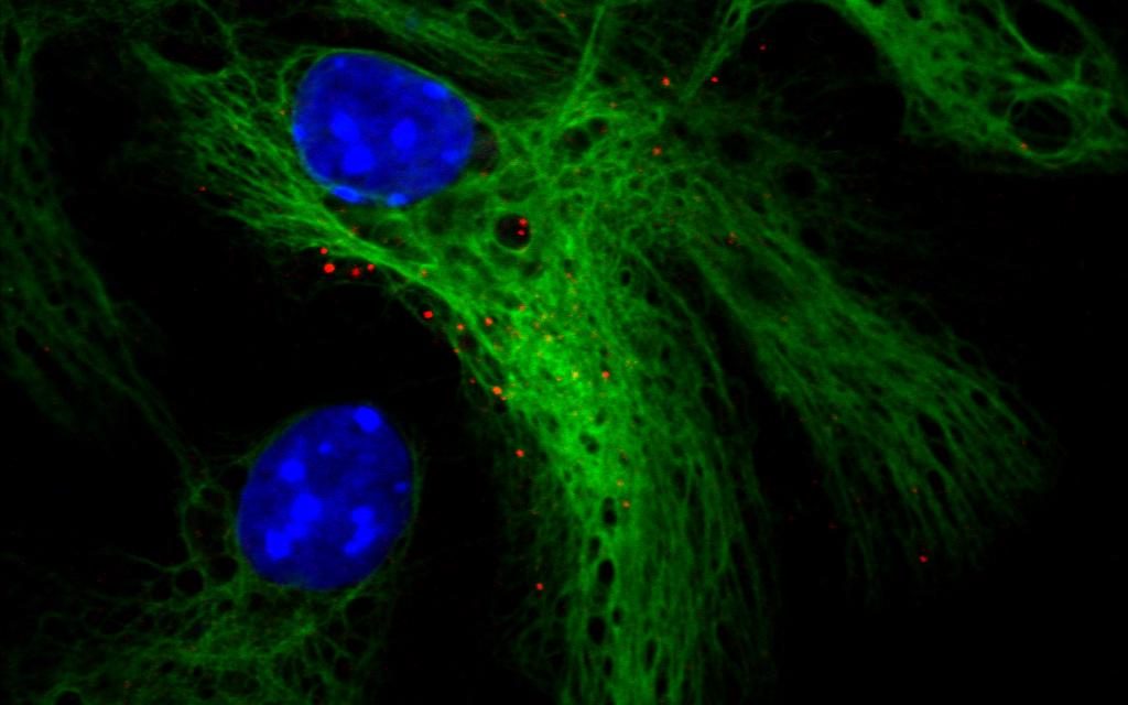 Chi decide del destino delle cellule staminali neurali?